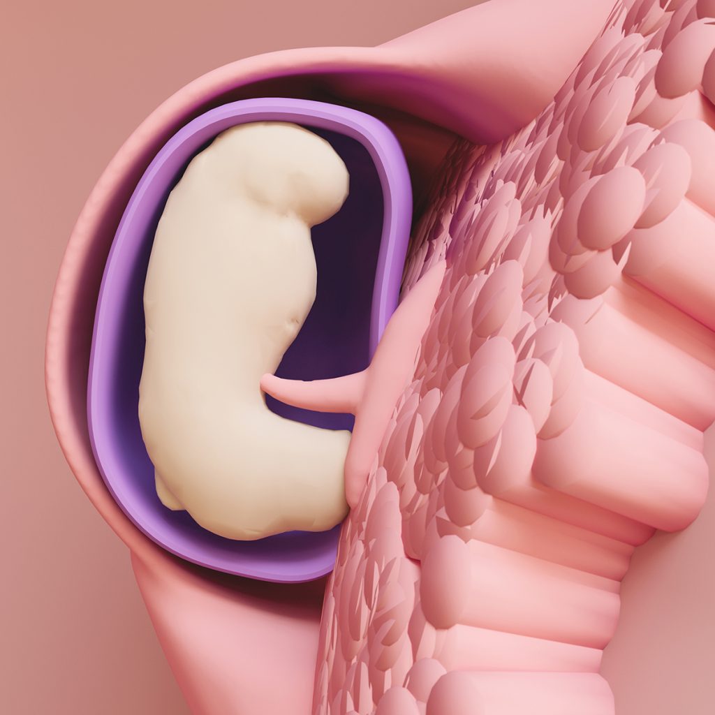 embryo implantation